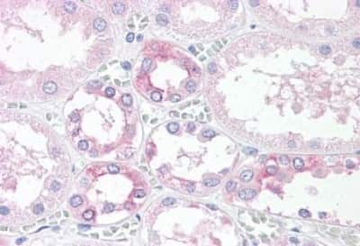 Immunohistochemistry-Paraffin: TM9SF4 Antibody [NBP3-14499]